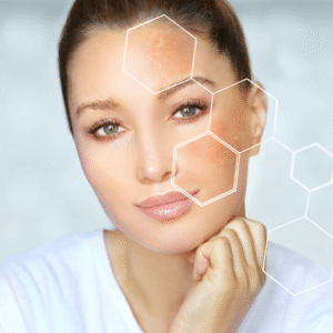 skin treatment