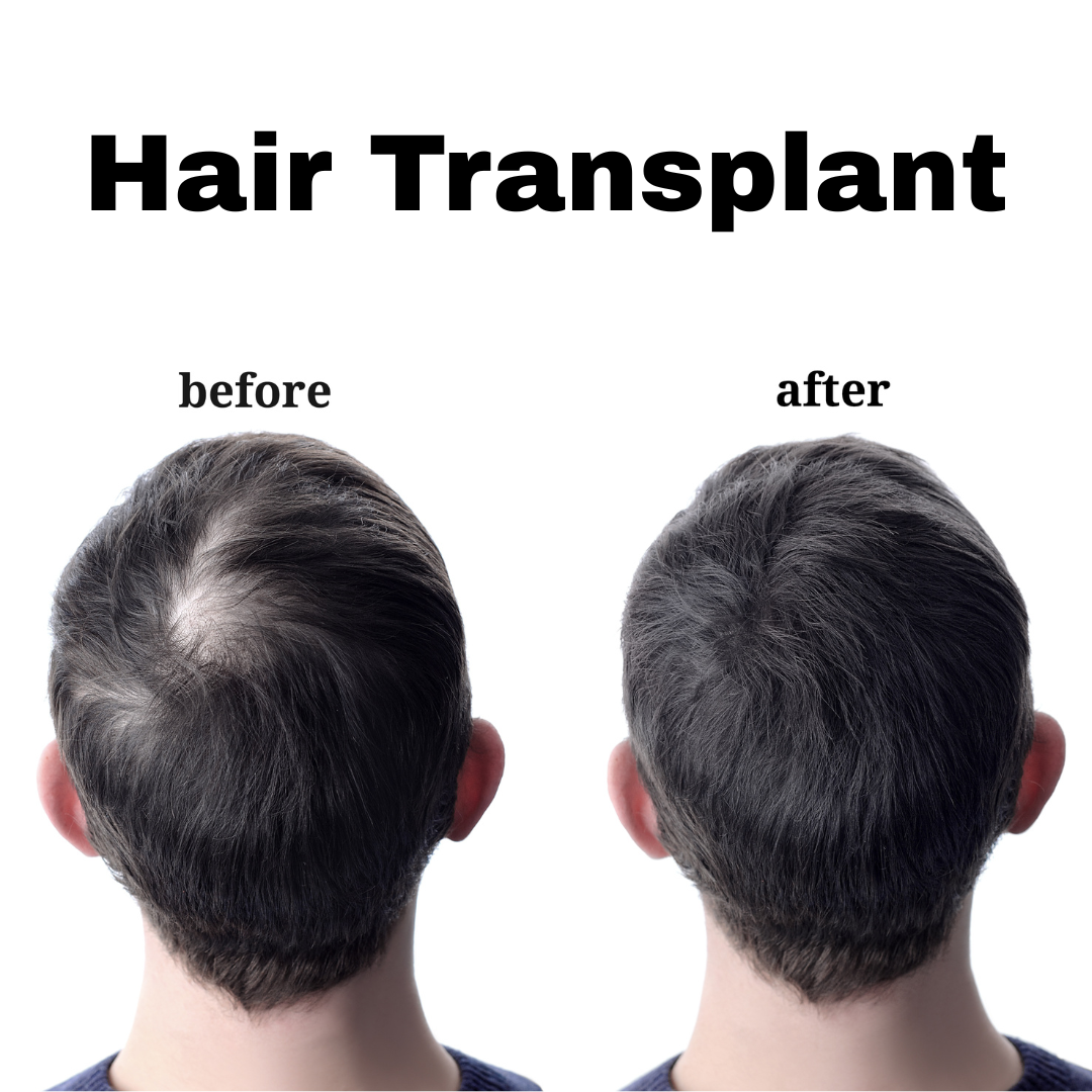 Hair treatment